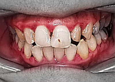 Before cosmetic dentistry treatments at TRUST dental