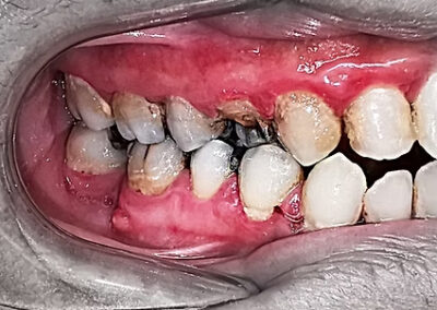 A close up of teeth before cosmetic dentistry