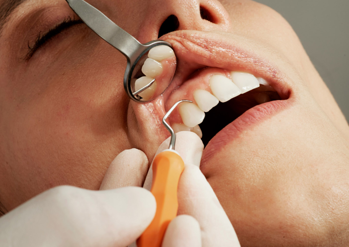 Periodontal Treatment - TD Close up of a dentist working on someones gums and teeth