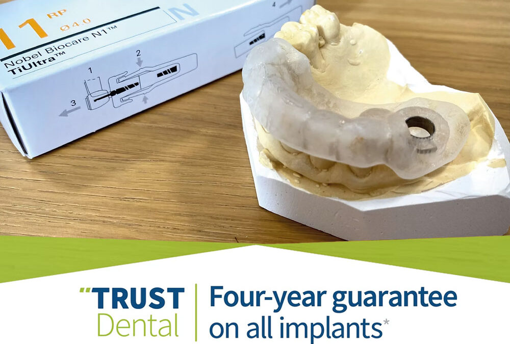 Four-Year Guarantee on All Implants