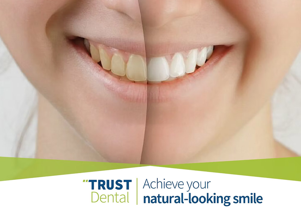 Natural looking smile