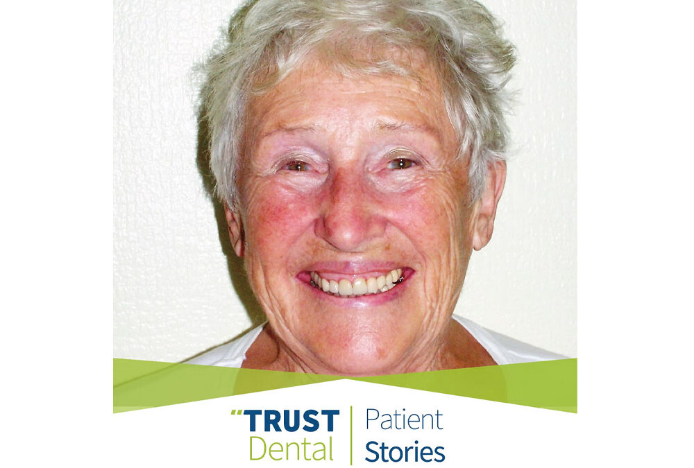 “Nowadays I cannot tell the difference between the implants and my own teeth!”